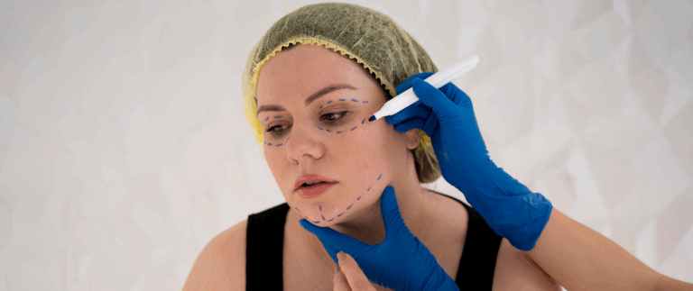 Introducing our new technique for lip enhancement